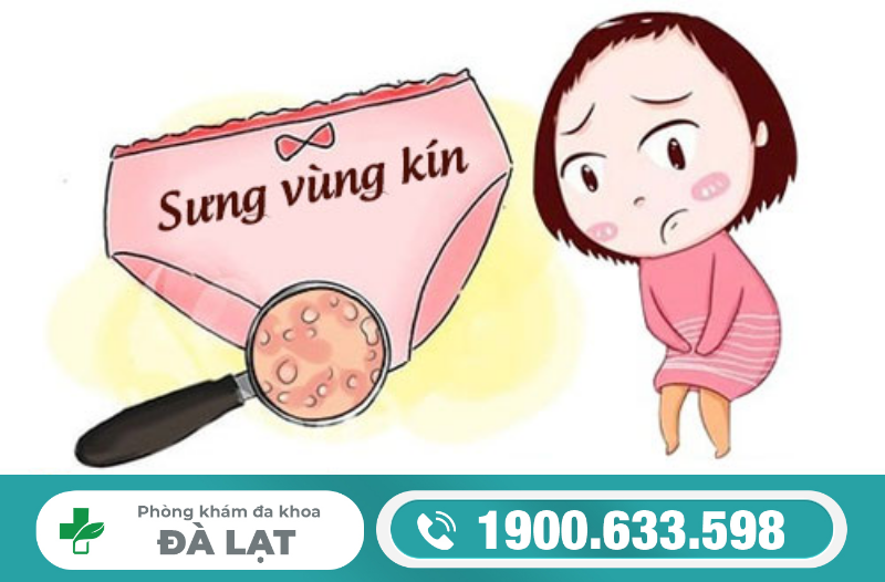 Hình ảnh minh họa